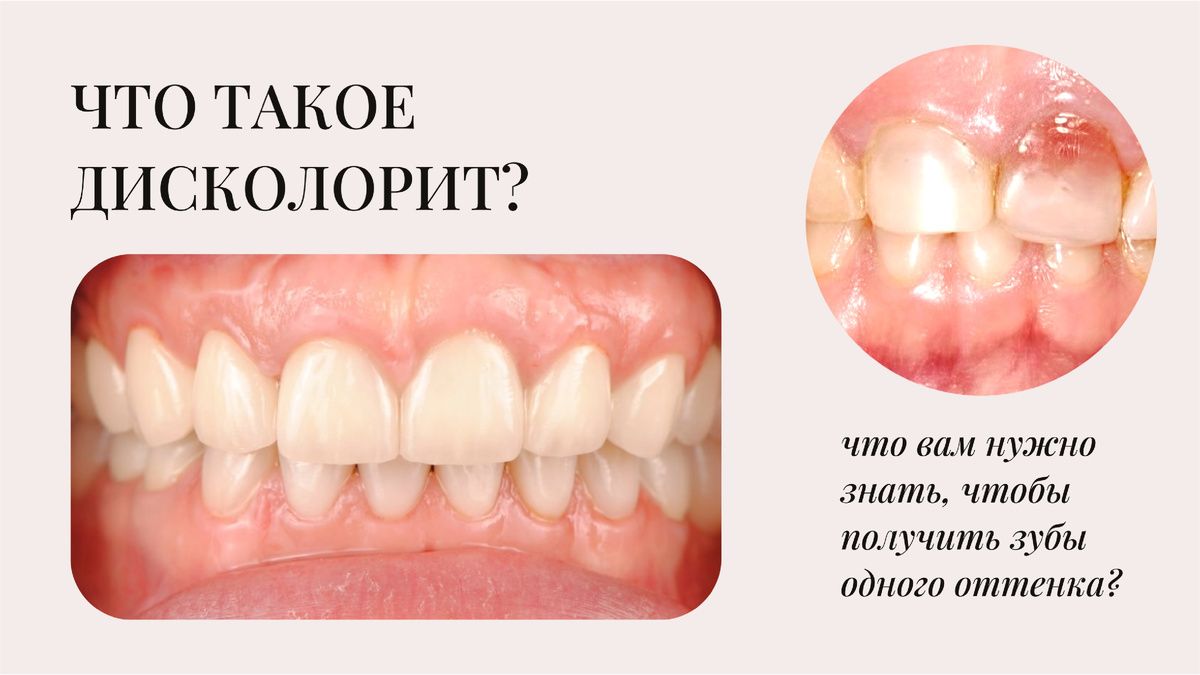 ���������� �����������: ��� �������� ��������� ������