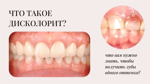 ���������� �����������: ��� �������� ��������� ������